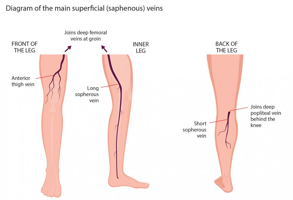 Normal Veins Vs Varicose Veins Differences Southwest Veins